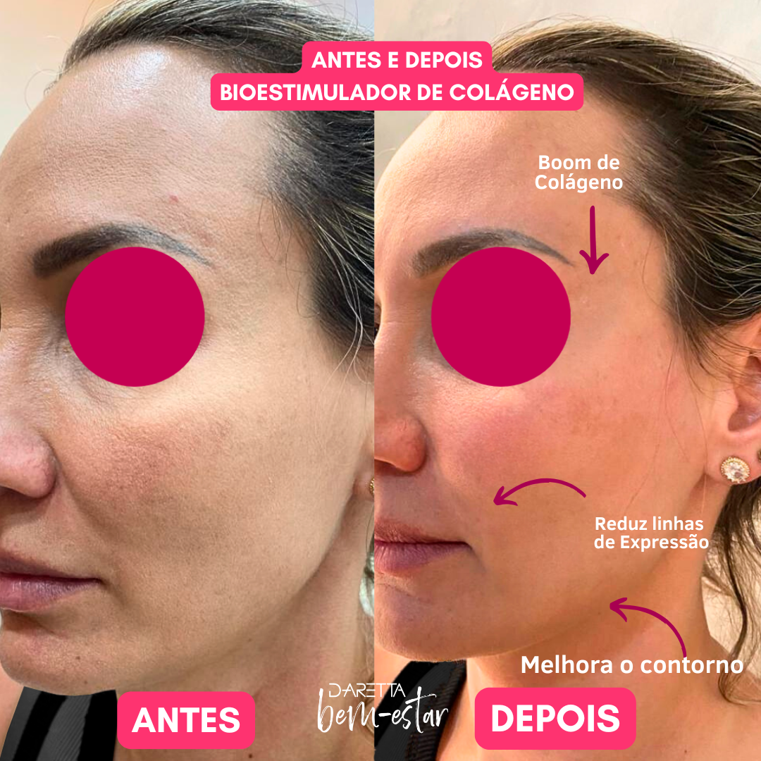 Resultados faciais